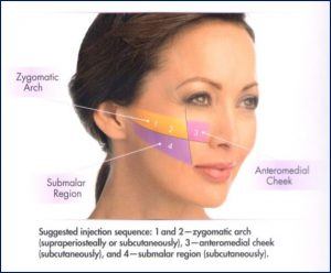 Quadrants of the Cheek