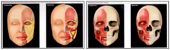 Sculptra below the surface